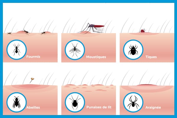 Piqures de punaises de lit : comment les traiter ?