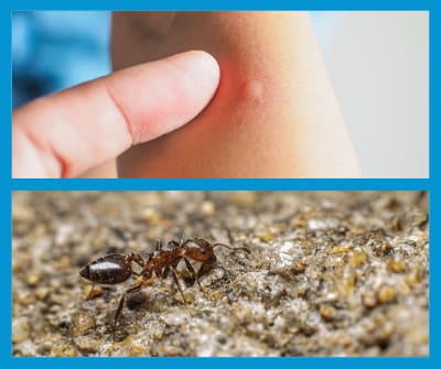 Les piqûres des fourmis