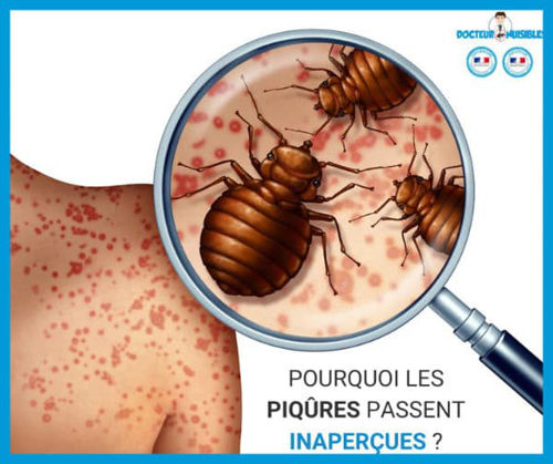 Punaises de lit : où les trouver et comment s'en débarrasser ? - K.Pro -  Nos solutions contre les insectes