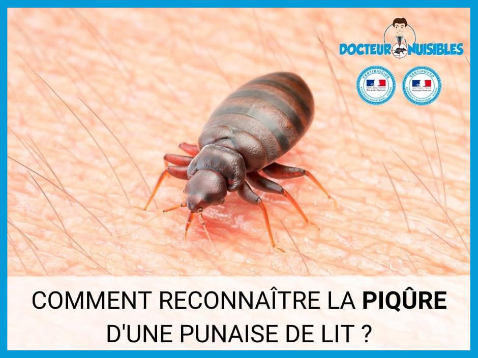 Piqûre punaise de lit : Comment reconnaître les piqûres de ...