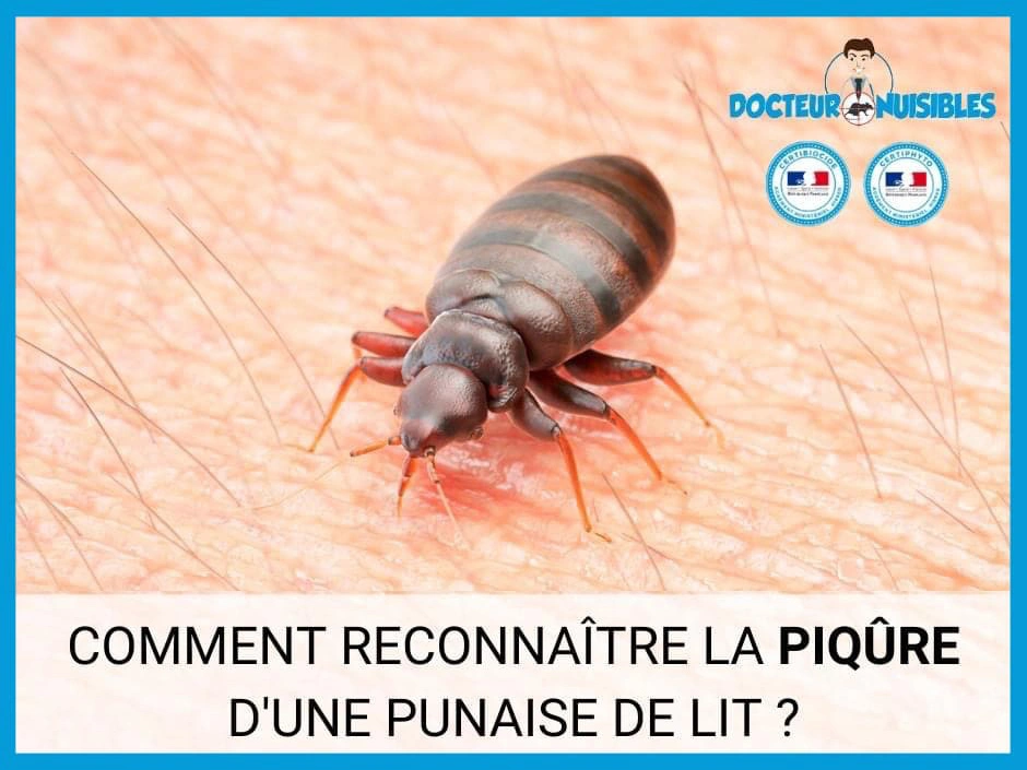 Comment Reconna tre Les Piq res De Punaises De Lit Traitement Et Photos Comment Reconna tre Les Piq res De Punaises De Lit Traitement Et Photos